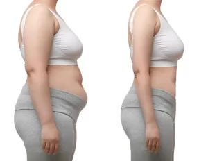 Semaglutide Weight loss in Amarillo before and after